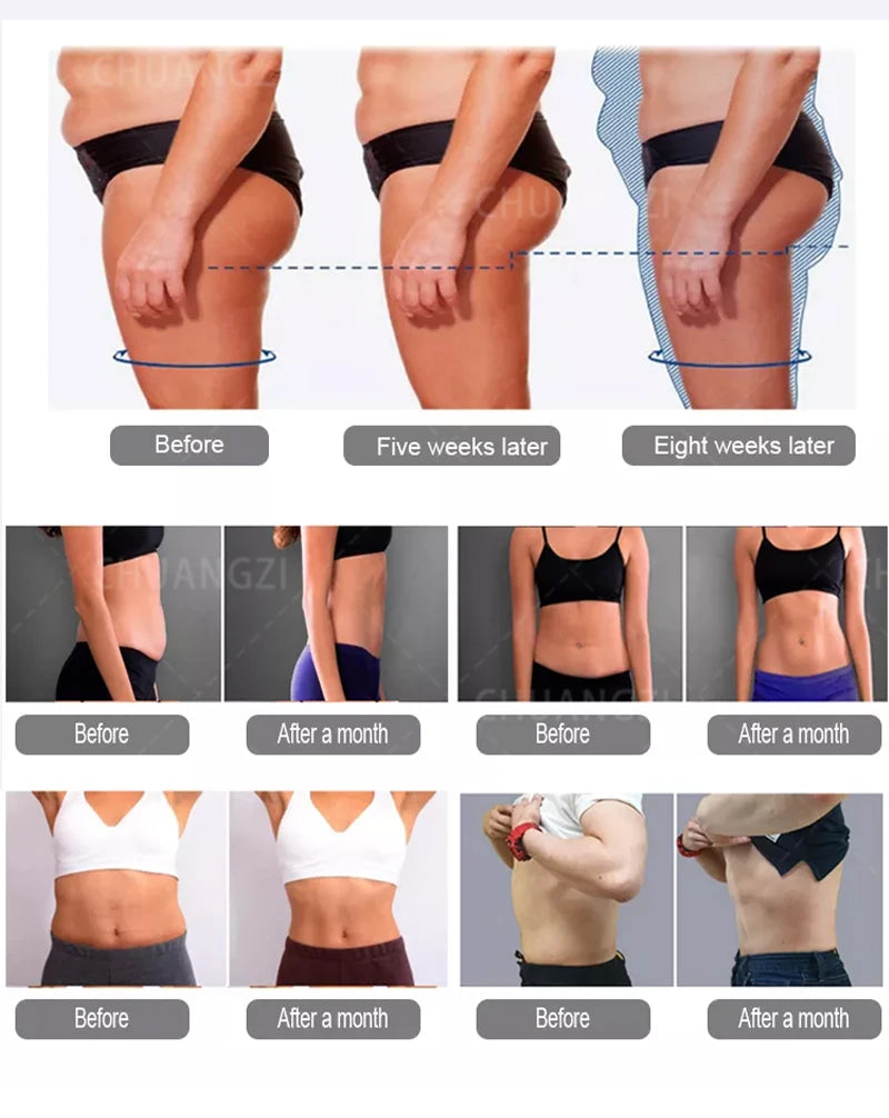 Portable HIEMT 6500W RF 15T 200HZ Body Shaper Muscle Growth Fat Burning High Intensity Electromagnetic Stimulator